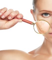 Manchas marrons nas mãos, como preveni-las?
